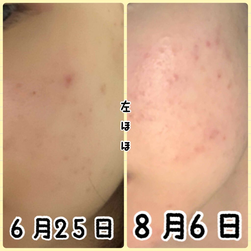 ニベアクリーム/ニベア/ボディクリームを使ったクチコミ(3枚目)