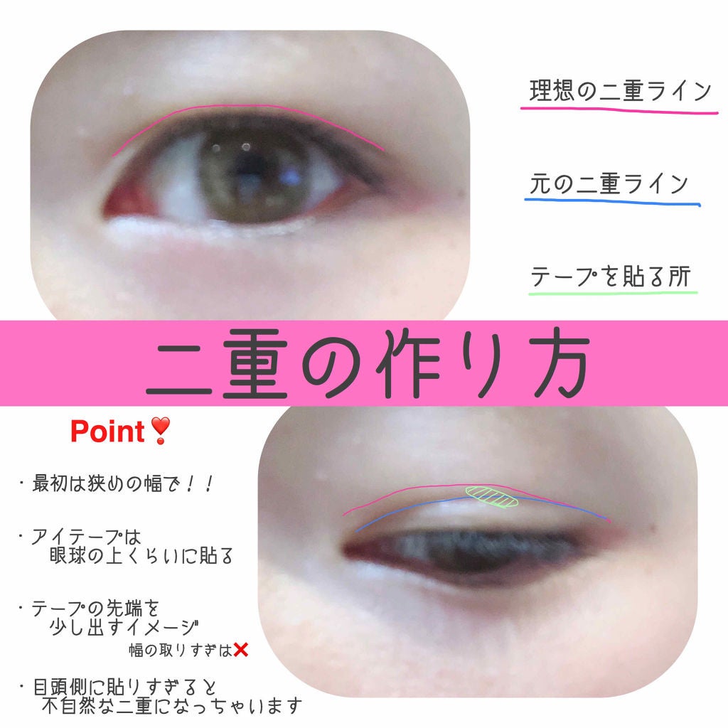 ワンダーアイリッドテープ 片面タイプ/D-UP/二重まぶた用アイテムを使ったクチコミ(3枚目)