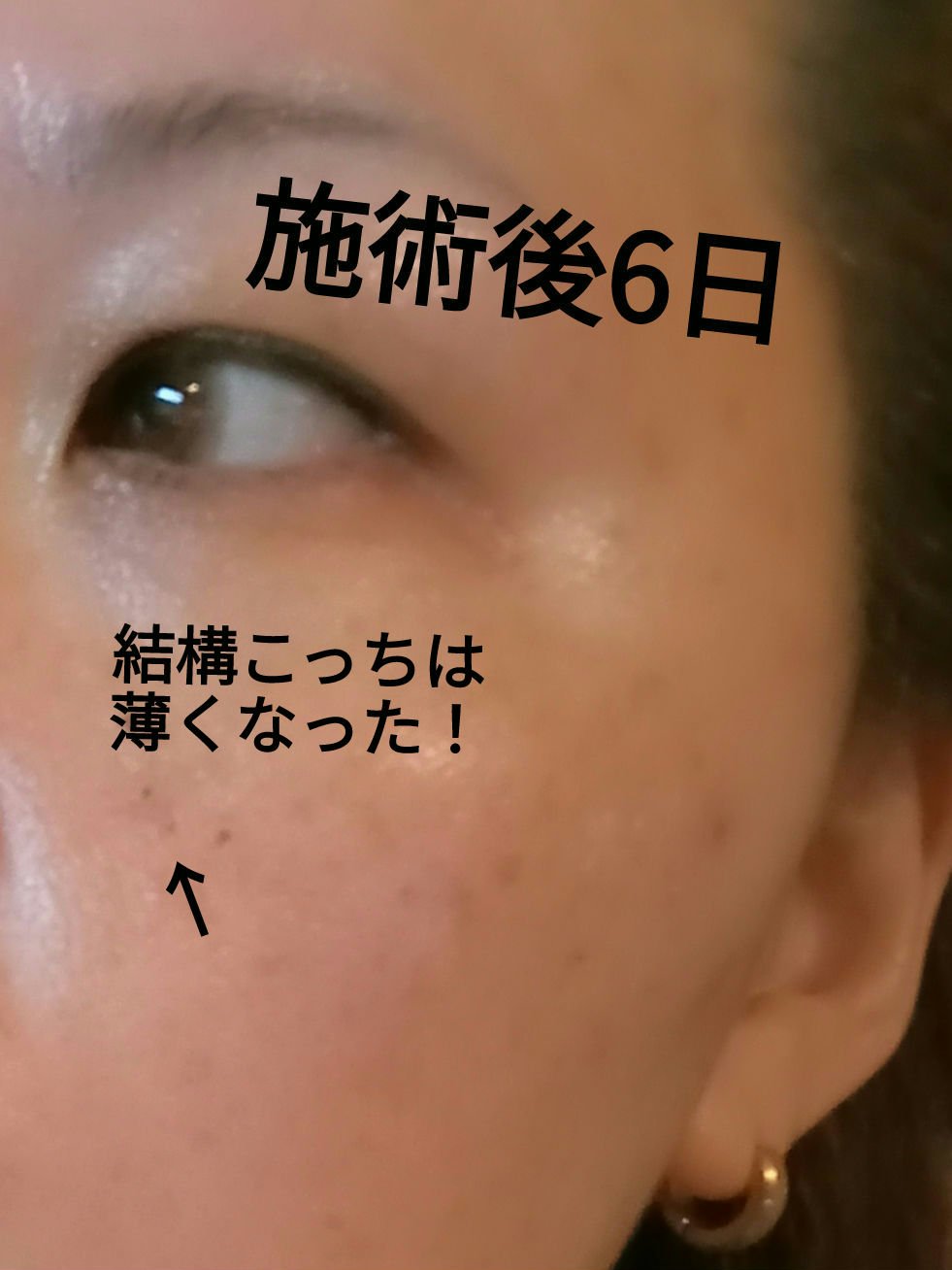 を使ったクチコミ（1枚目）