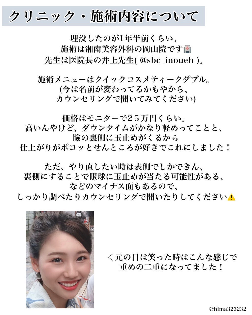 ひまちゃん /垢抜けの参考書 on LIPS 「【整形】〜私が施術した二重埋没について〜本日は!1年半くらい前..」(3枚目)