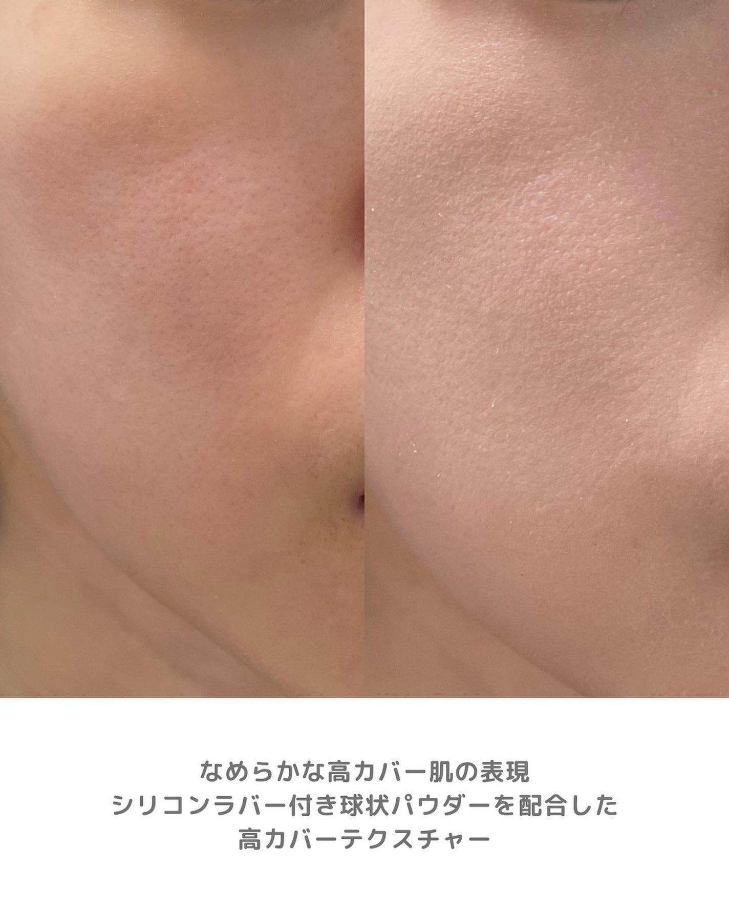 ピンクティーツリーカバークッション/APLIN/クッションファンデーションを使ったクチコミ(5枚目)