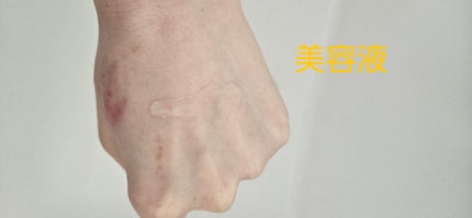 センテラ アンプル/SKIN1004/美容液を使ったクチコミ(1枚目)