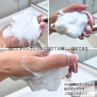 A アクネソープ/NOV/洗顔石鹸を使ったクチコミ（3枚目）