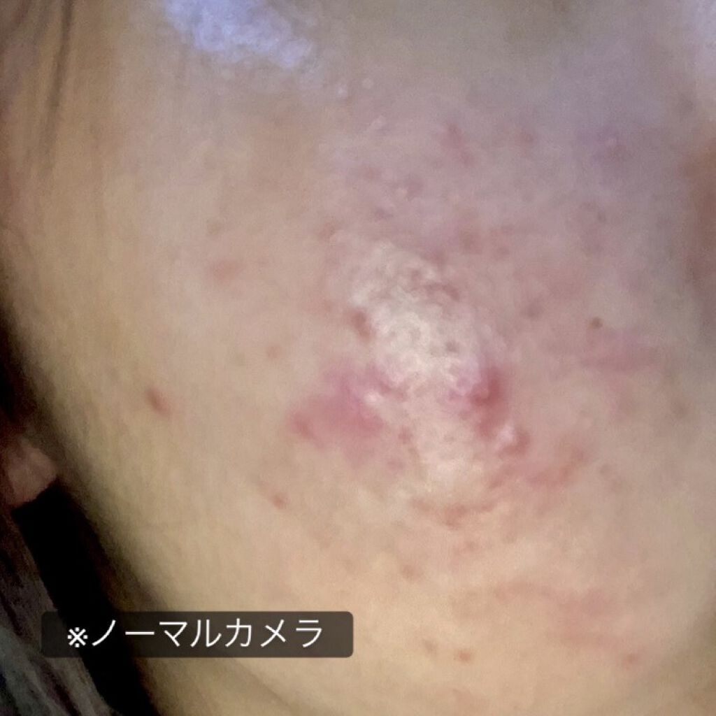 ImmunityH+クリーム/immunityH+/フェイスクリームを使ったクチコミ（3枚目）