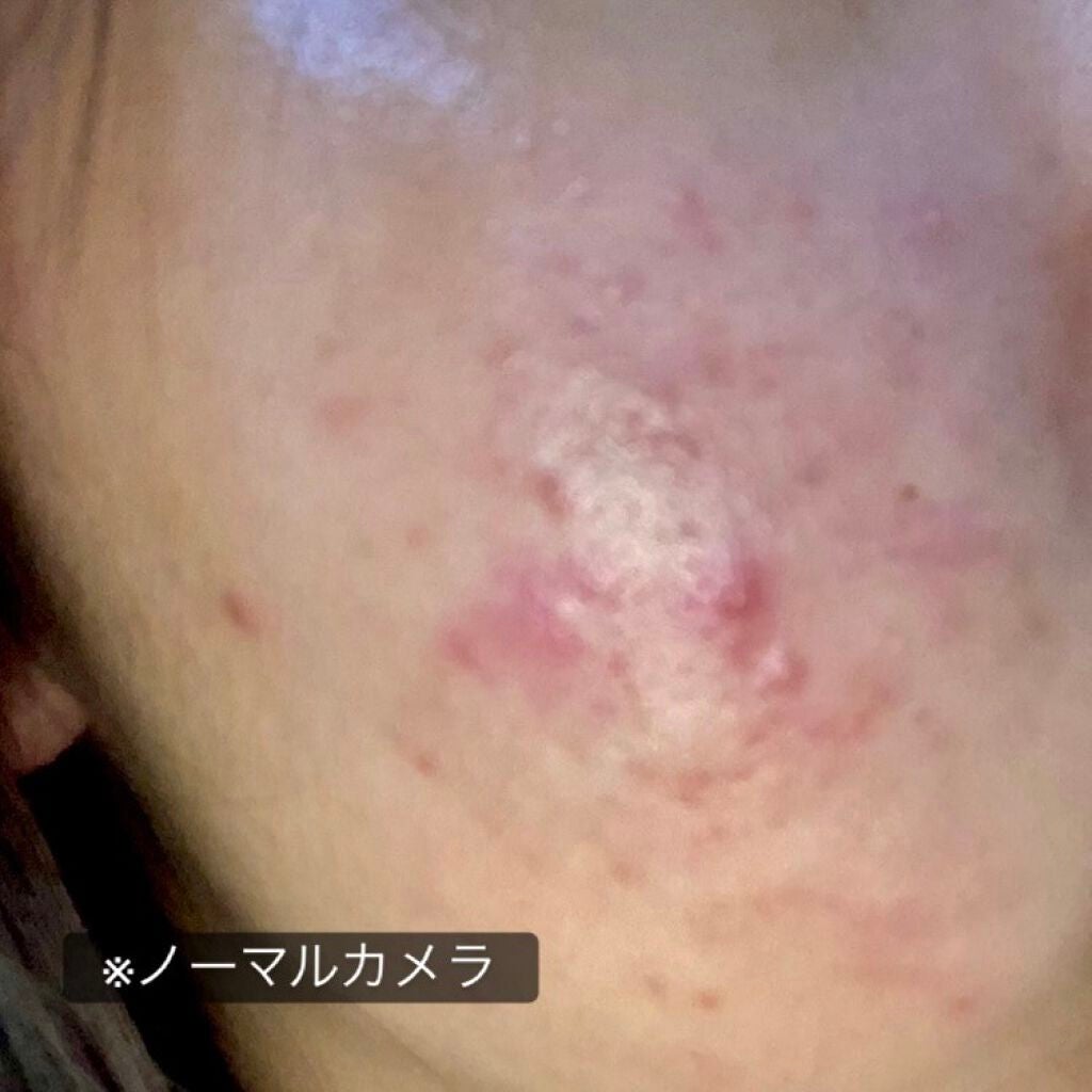 ImmunityH+/immunityH+/化粧水を使ったクチコミ(3枚目)