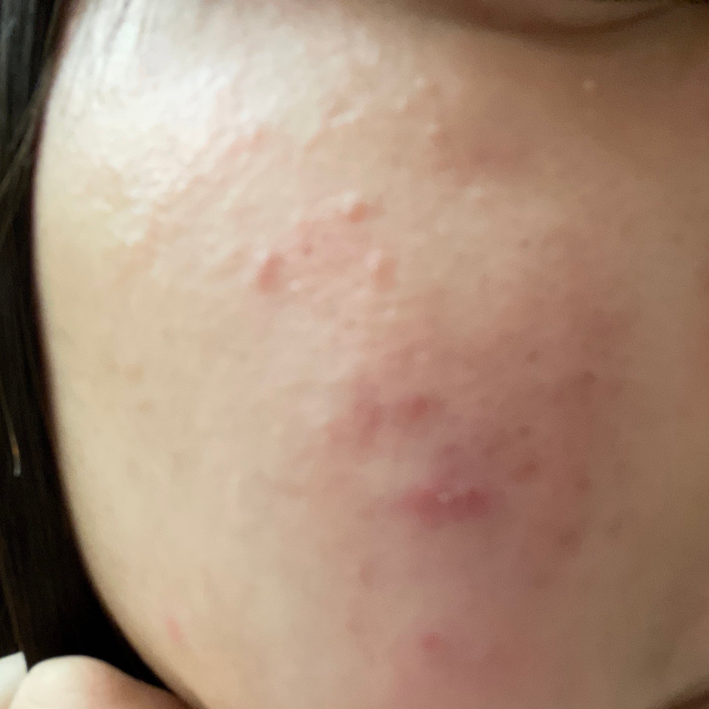 YUNA.2 on LIPS 「今この化粧水を使ってるんですけど効果とかはありますか?!普通乳..」(2枚目)