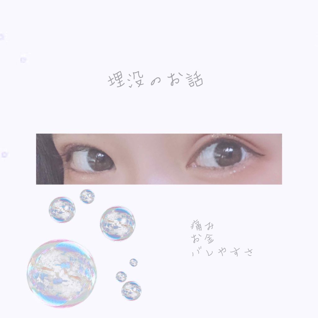 みち on LIPS 「こんにちは、最近埋没を夏休みにした方が多いみたいですねΣ(˙꒳..」(1枚目)