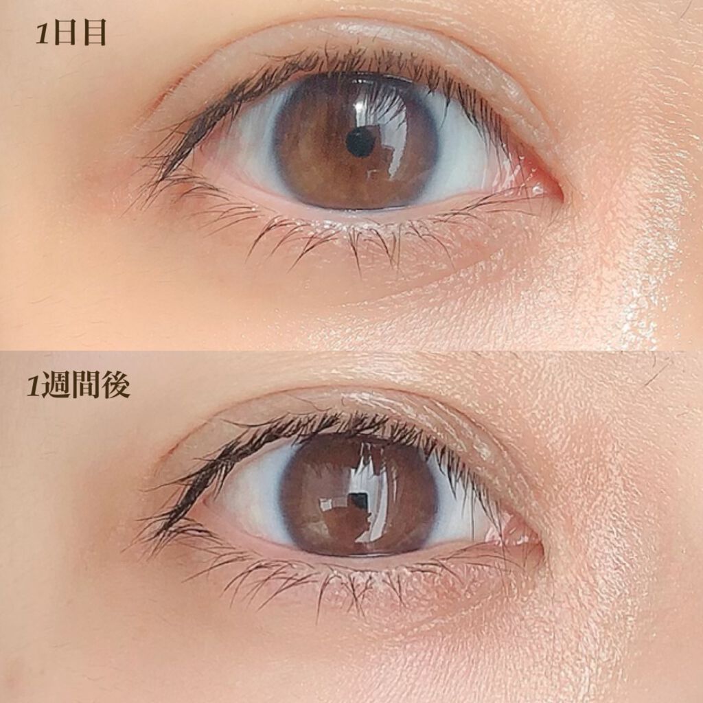 ザ リンクレス/ONE BY KOSE/アイケア・アイクリームを使ったクチコミ(2枚目)