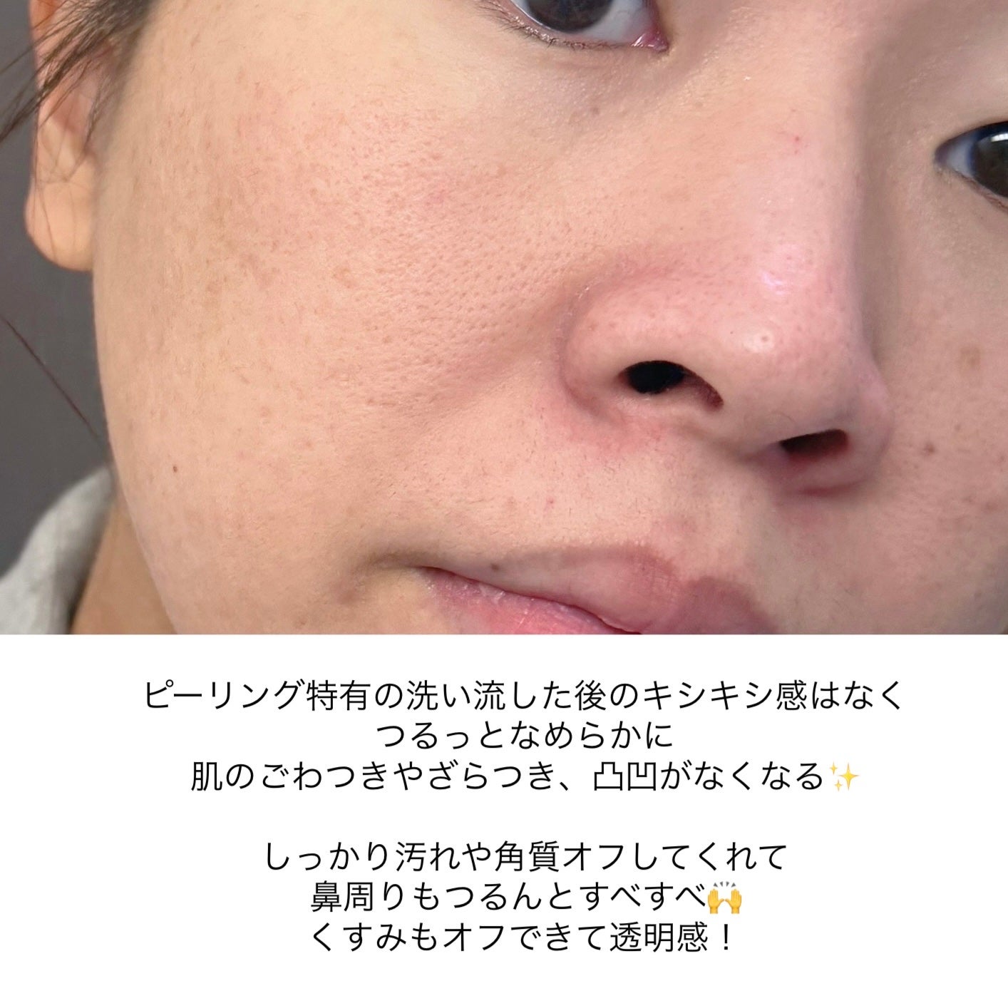 ENERGY REFRESH PEELING GEL/WONJIN EFFECT/ピーリングを使ったクチコミ(5枚目)