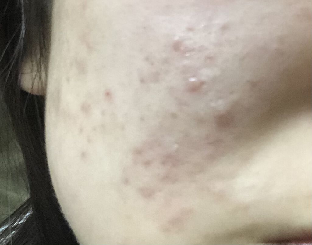 を使ったクチコミ（1枚目）