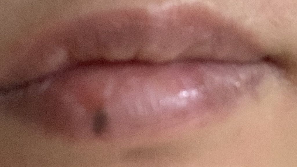 CICA ナイトリップマスク/VT/リップマスクを使ったクチコミ（1枚目）