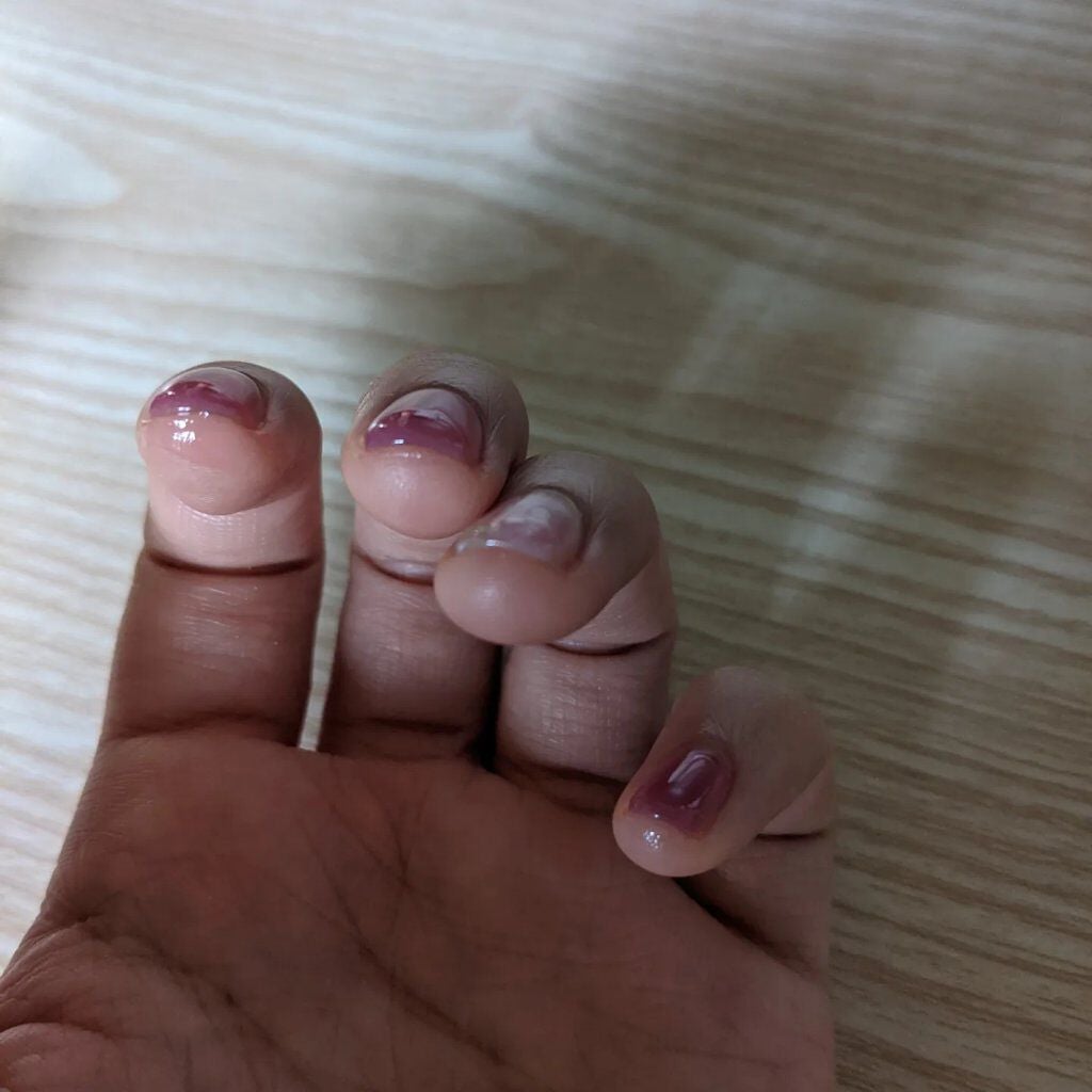 ポニキウムオイル/enieni /ネイルオイル・トリートメントを使ったクチコミ(5枚目)