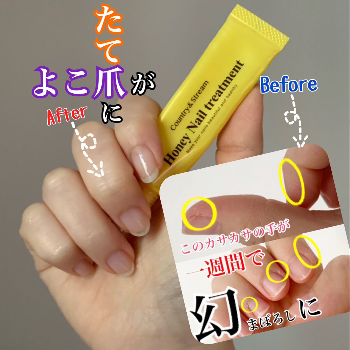 ネイルトリートメントオイル/カントリー&ストリーム/ネイルオイル・トリートメントを使ったクチコミ（1枚目）