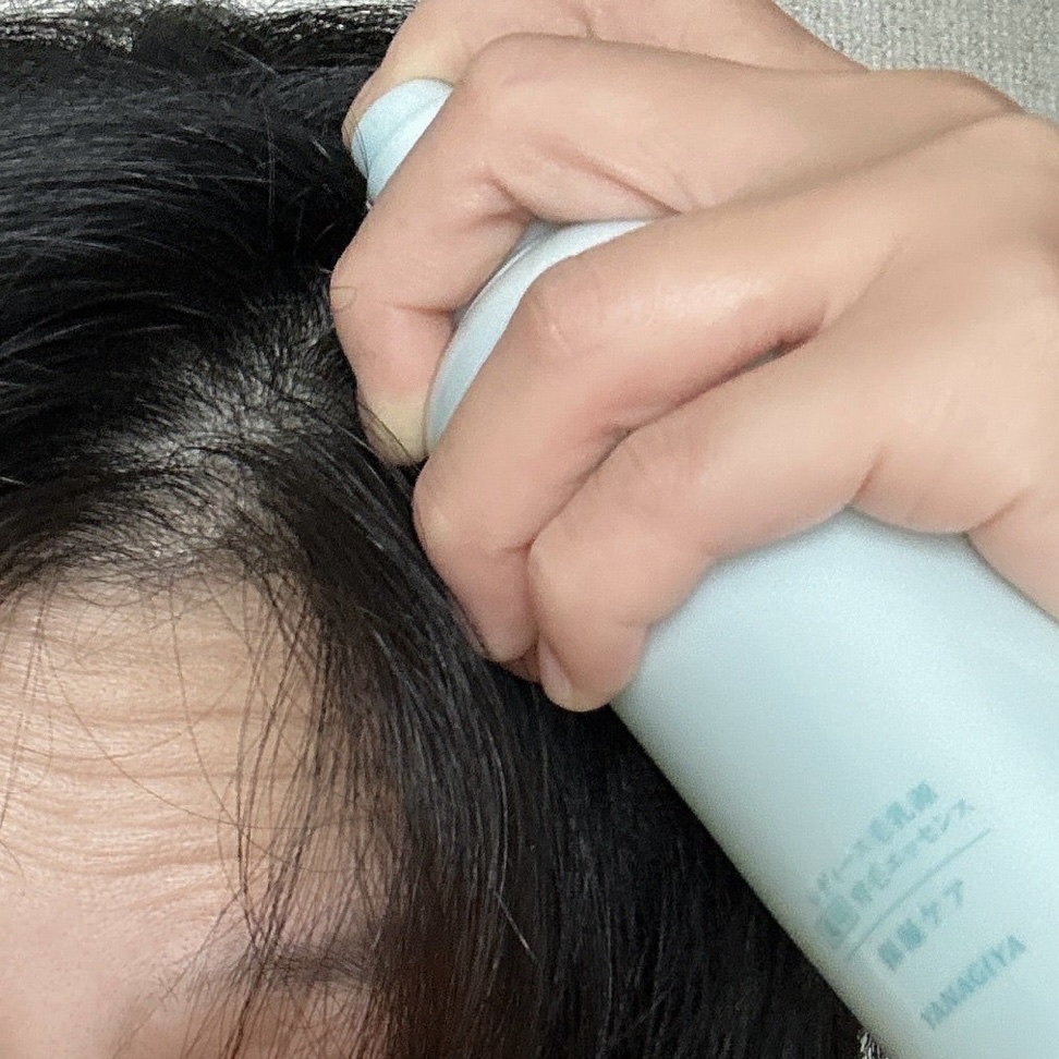 レディース頭皮ケア うるおいエッセンス/柳屋/頭皮ローションを使ったクチコミ（3枚目）