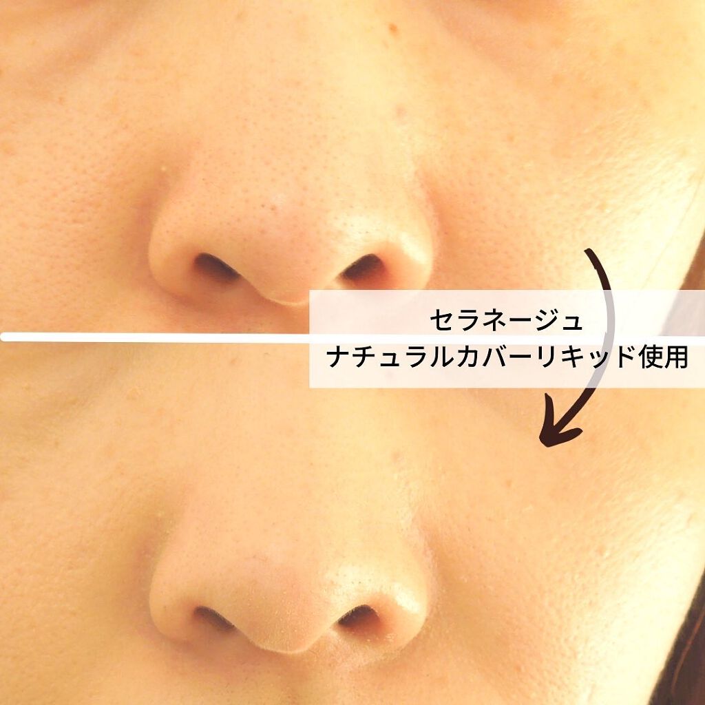 セラネージュ ナチュラルカバーリキッド/CeraLabo/リキッドファンデーションを使ったクチコミ(3枚目)