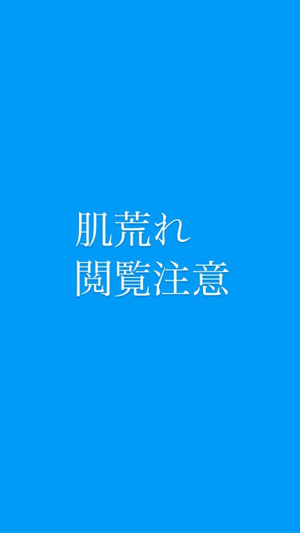 ドルマイシン軟膏(医薬品)/ゼリア新薬工業/その他を使ったクチコミ(1枚目)