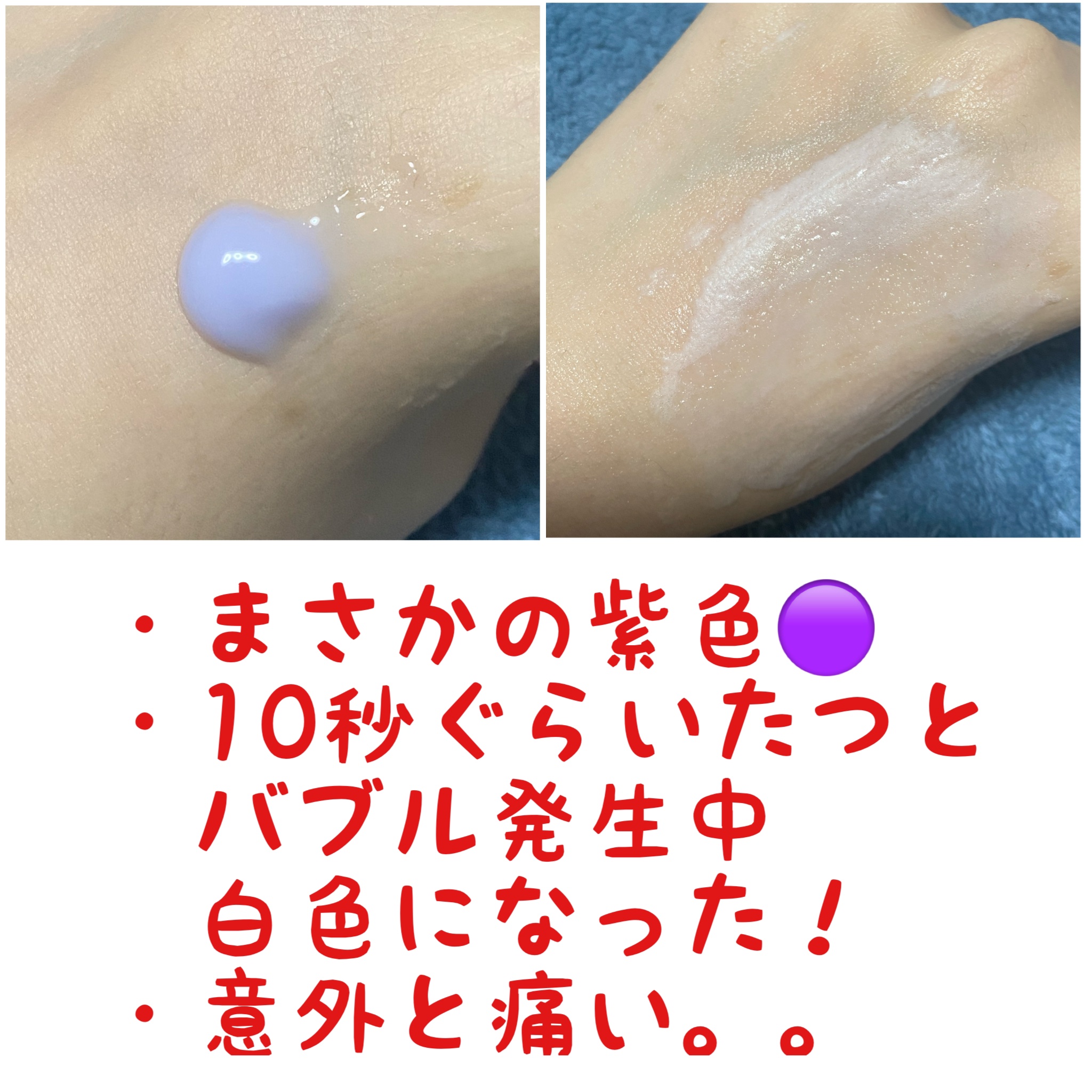 ペプチド ボリューム マスター エッセンス/DR.PEPTI/美容液を使ったクチコミ（2枚目）