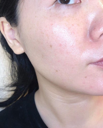 スキンメインテナイザー EX W2/リサージ/化粧水を使ったクチコミ(7枚目)