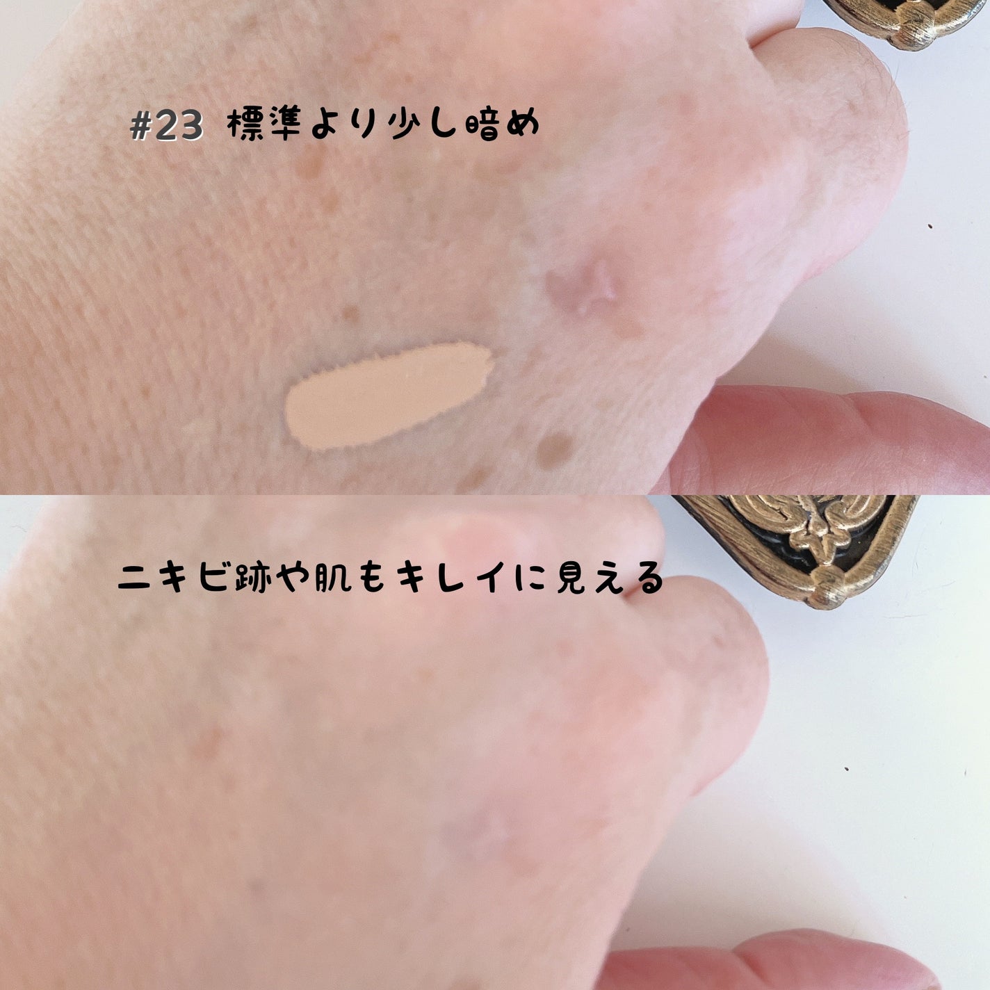 レッドコンシーラー/MEDICUBE/リキッドコンシーラーを使ったクチコミ(1枚目)