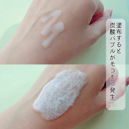 スパークリングスカルプスケーラー/ミンツリー/頭皮ケアを使ったクチコミ(4枚目)