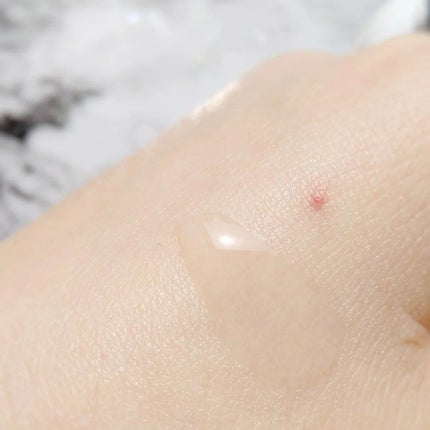 VC ホワイトピールセラム/SKIO/ブースター・導入液を使ったクチコミ(3枚目)