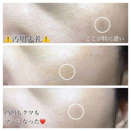 マルチカバー コンシーラー/ESPRIQUE/リキッドコンシーラーを使ったクチコミ(6枚目)