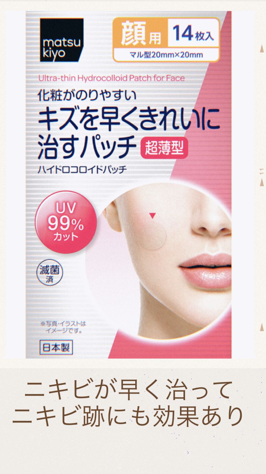 キズを早くきれいに治すパッチ/matsukiyo/その他を使ったクチコミ(1枚目)