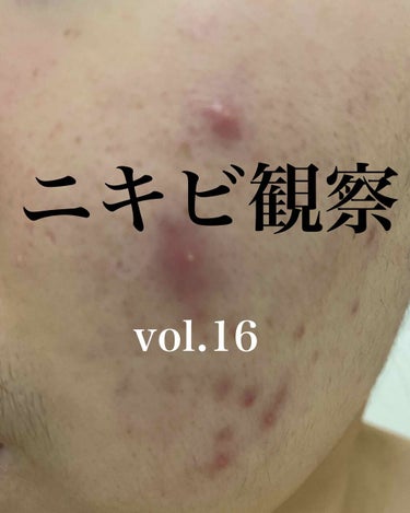 敏感肌用薬用美白美容液/無印良品/美容液を使ったクチコミ（1枚目）