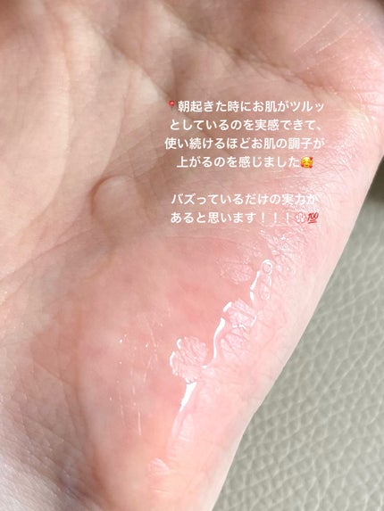 エファクラ ピールケア セラム/ラ ロッシュ ポゼ/美容液を使ったクチコミ(4枚目)