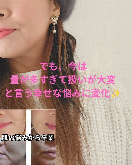 美肌カウンセラー💆肌悩みを解決し見る世界を変える on LIPS 「大人の髪のトリセツ髪で印象も雰囲気もかわる!髪に、艶、ハリ、こ..」(6枚目)