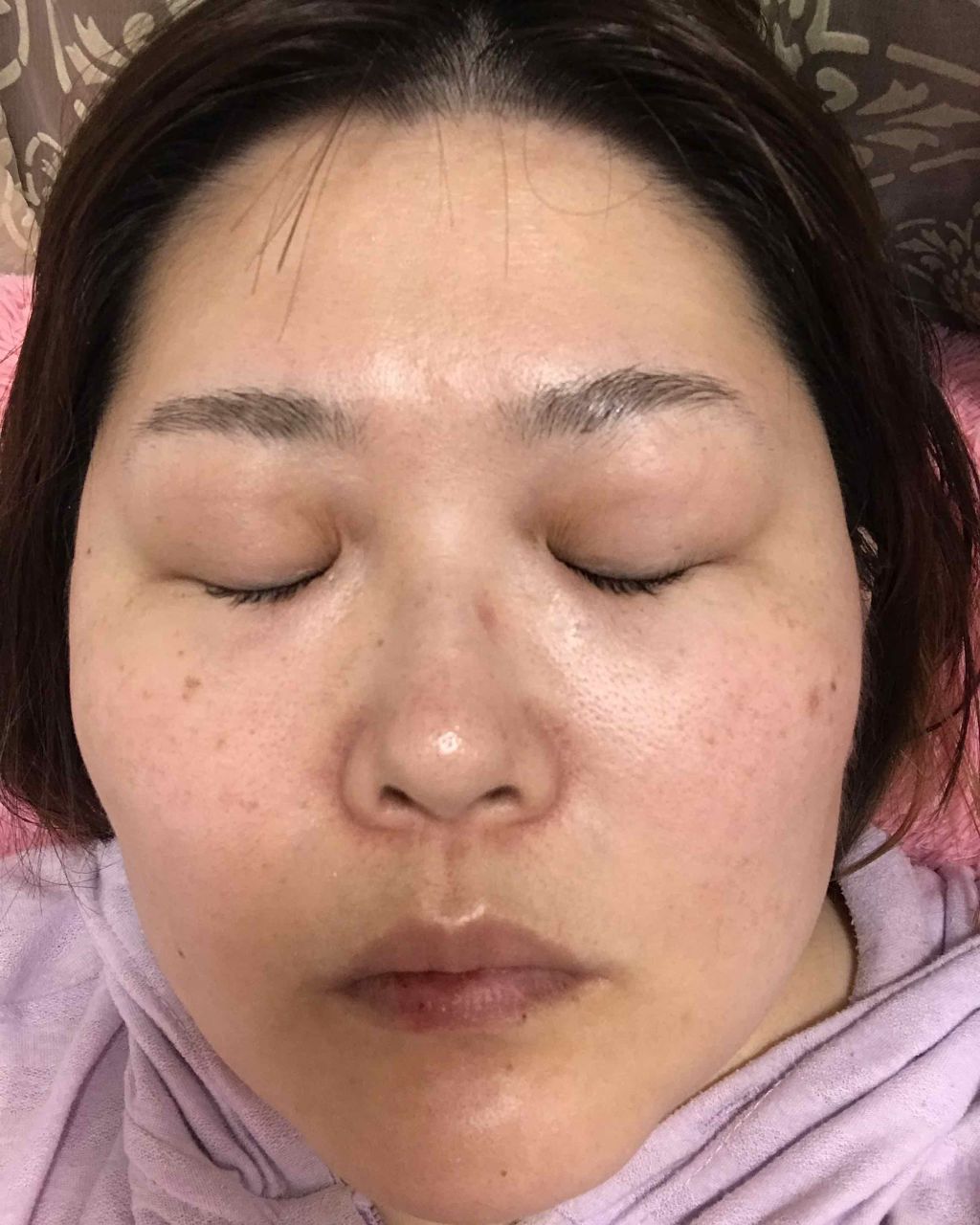 リンクルリペア ローション/ルシェリ/化粧水を使ったクチコミ(2枚目)