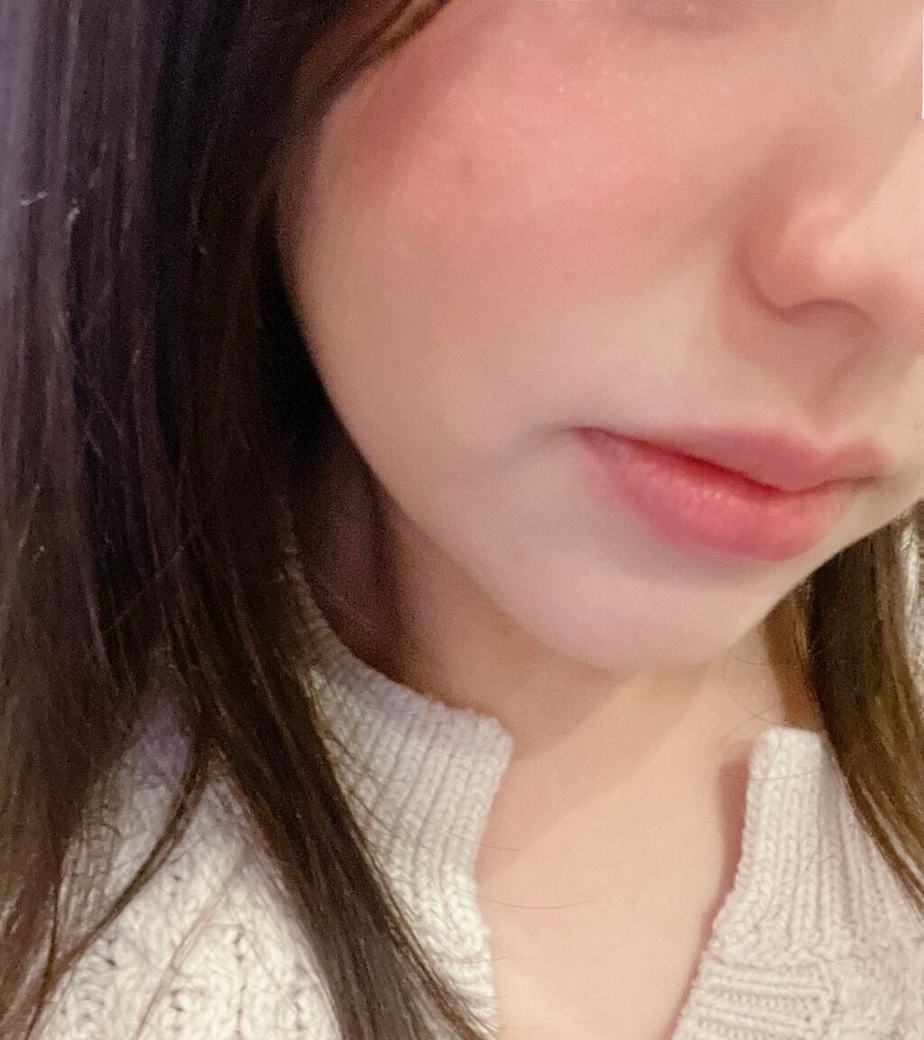 シアーグロウスティック チークカラー/ミゼルエディ/ジェル・クリームチークを使ったクチコミ(3枚目)