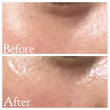 チェリーブロッサム ブレミッシュ 8GF スティック アイクリーム/Bring Back/アイケア・アイクリームを使ったクチコミ(4枚目)