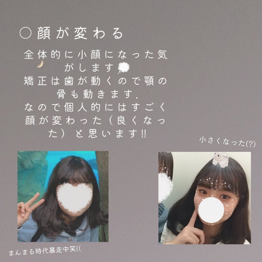 ま り on LIPS 「⸜歯科矯正をして良かったこと.⸝やっほっほ~~‼まりだよ~~✌..」(2枚目)