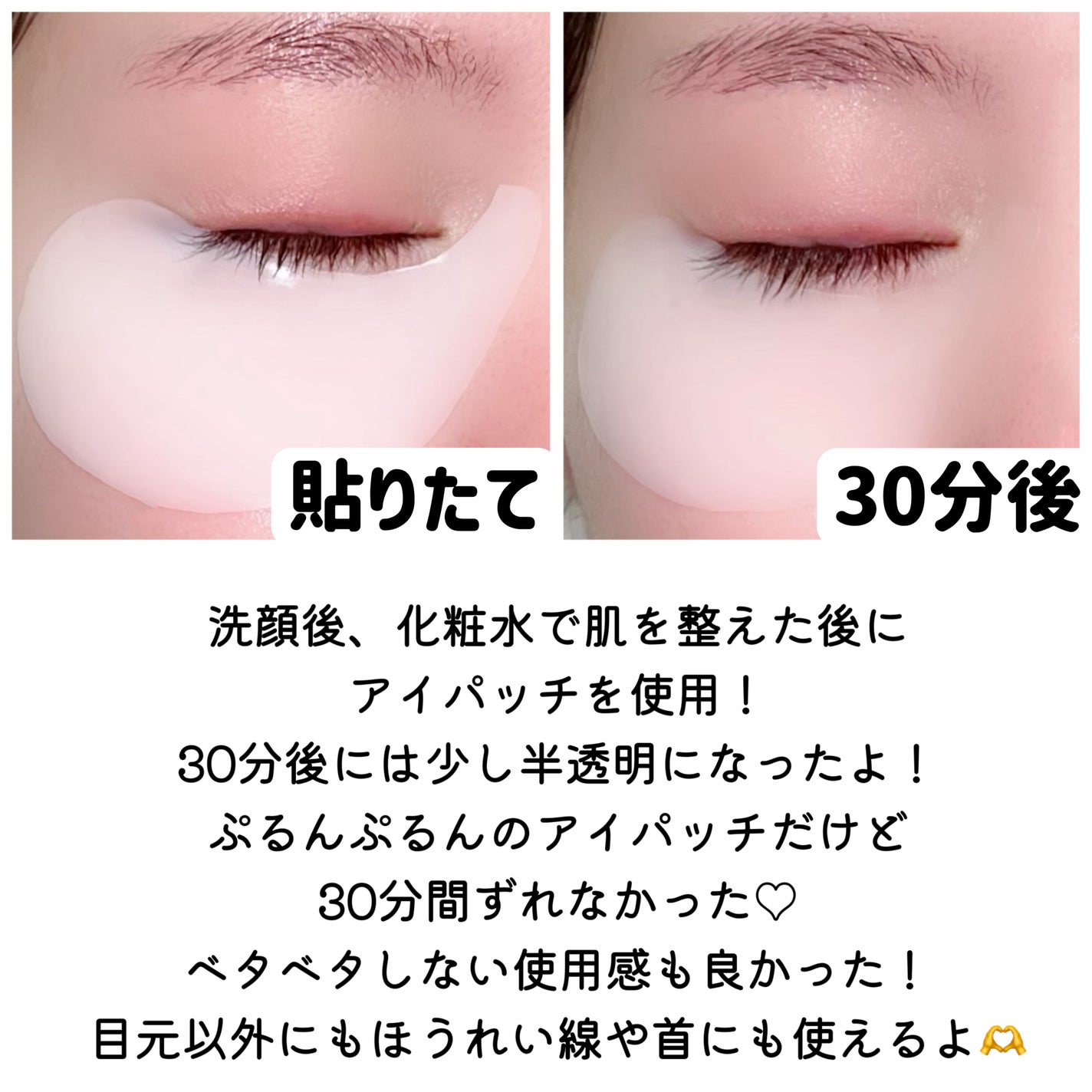 ホワイトトリュフインテンシブザリアルアイパッチ/ダルバ/アイケア・アイクリームを使ったクチコミ(3枚目)