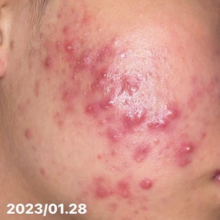 ベリーお元気?/ラッシュ/洗い流すパック・マスクを使ったクチコミ(2枚目)