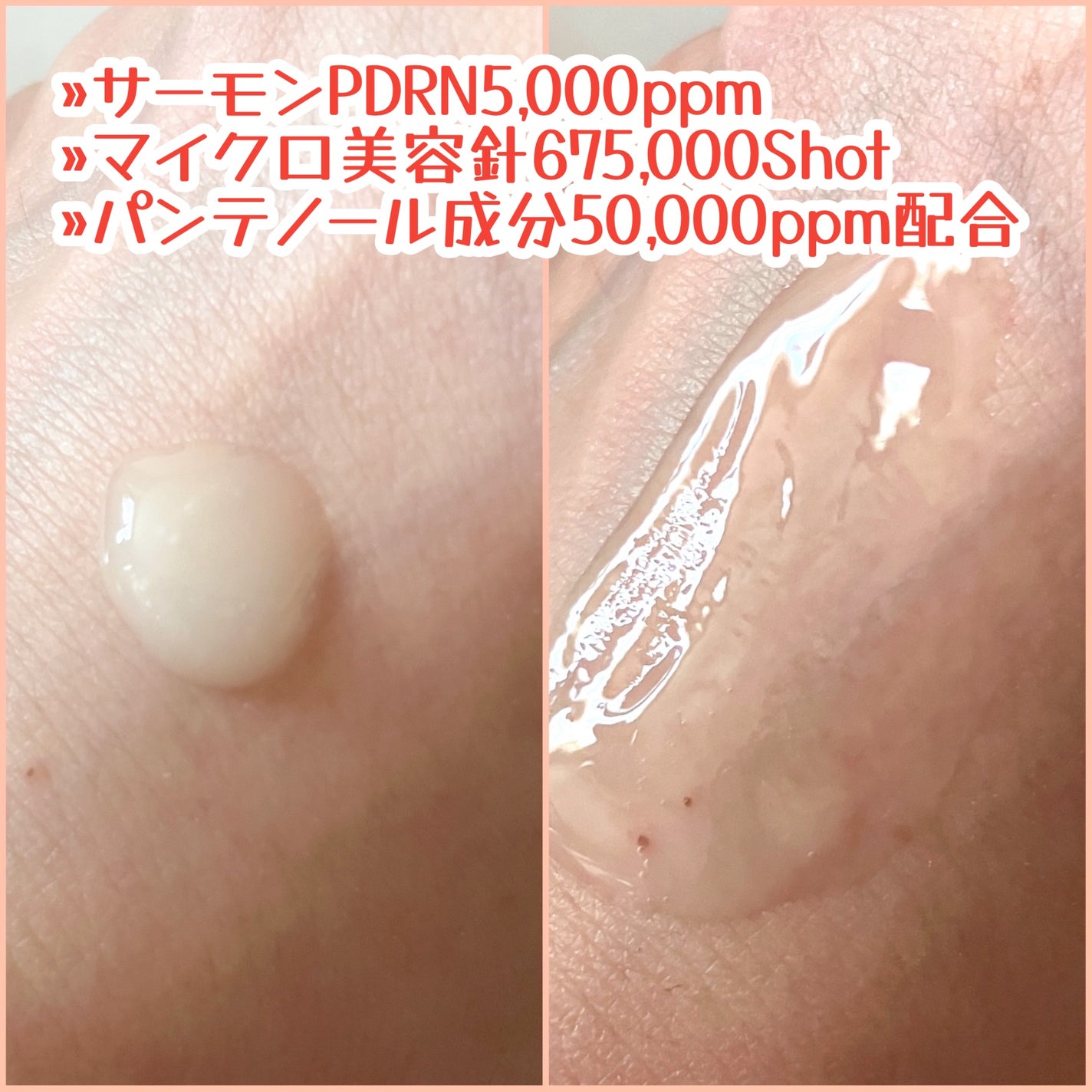 PDRNショット675/COSNORI/美容液を使ったクチコミ(3枚目)