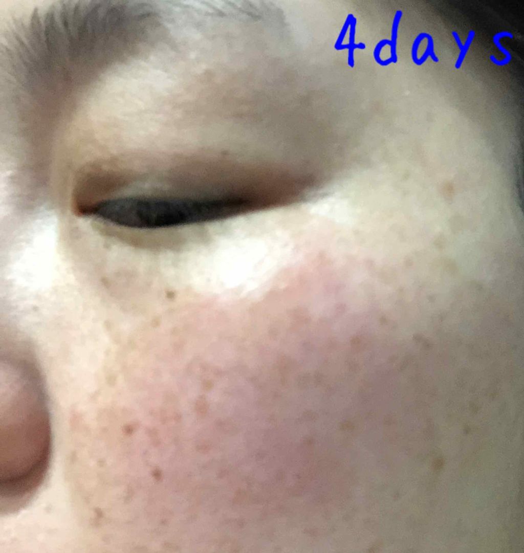 ホワイト 薬用ドットゼロ/リッツ/美容液を使ったクチコミ(1枚目)