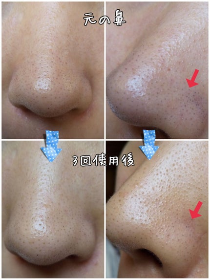 ホワイト もこもこ白泡マスク/リッツ/洗い流すパック・マスクを使ったクチコミ(2枚目)