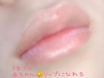 センシティブ/Blistex/リップクリームを使ったクチコミ(3枚目)