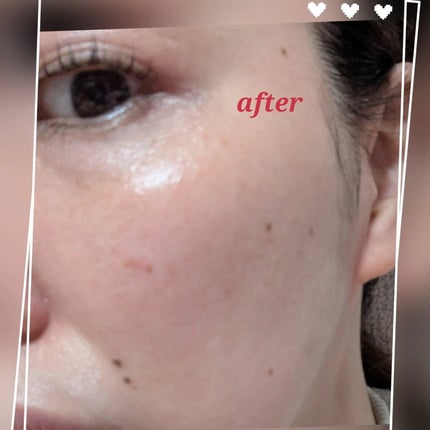 プロバイオシカ インテンシブ アンプル/SKIN1004/美容液を使ったクチコミ(7枚目)