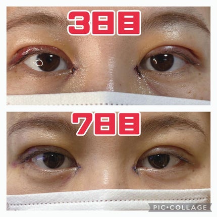 を使ったクチコミ(1枚目)