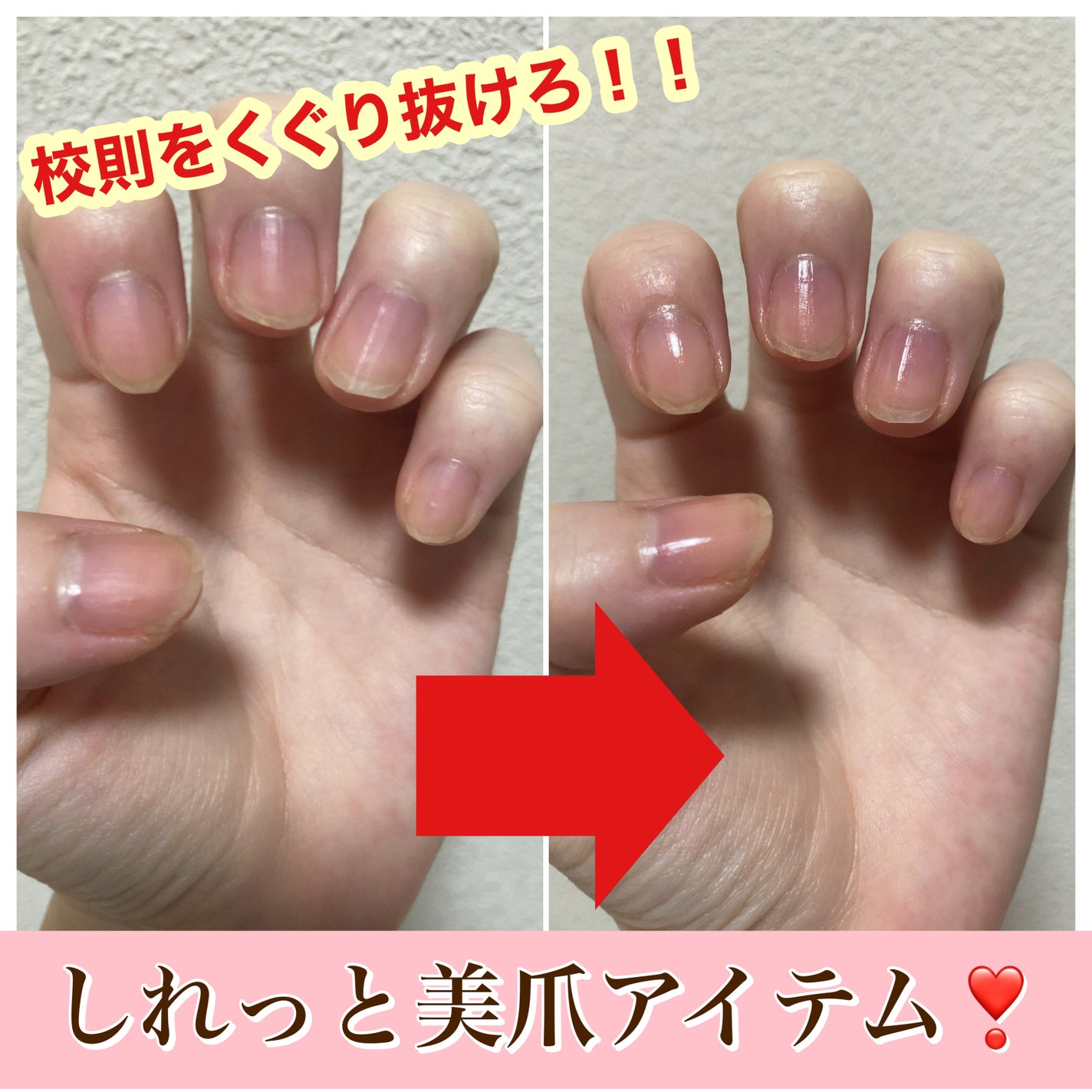 エテュセ クイックケアコート/ettusais/ネイルオイル・トリートメントを使ったクチコミ(1枚目)