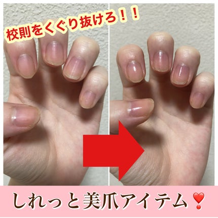 エテュセ クイックケアコート/ettusais/ネイルオイル・トリートメントを使ったクチコミ(1枚目)