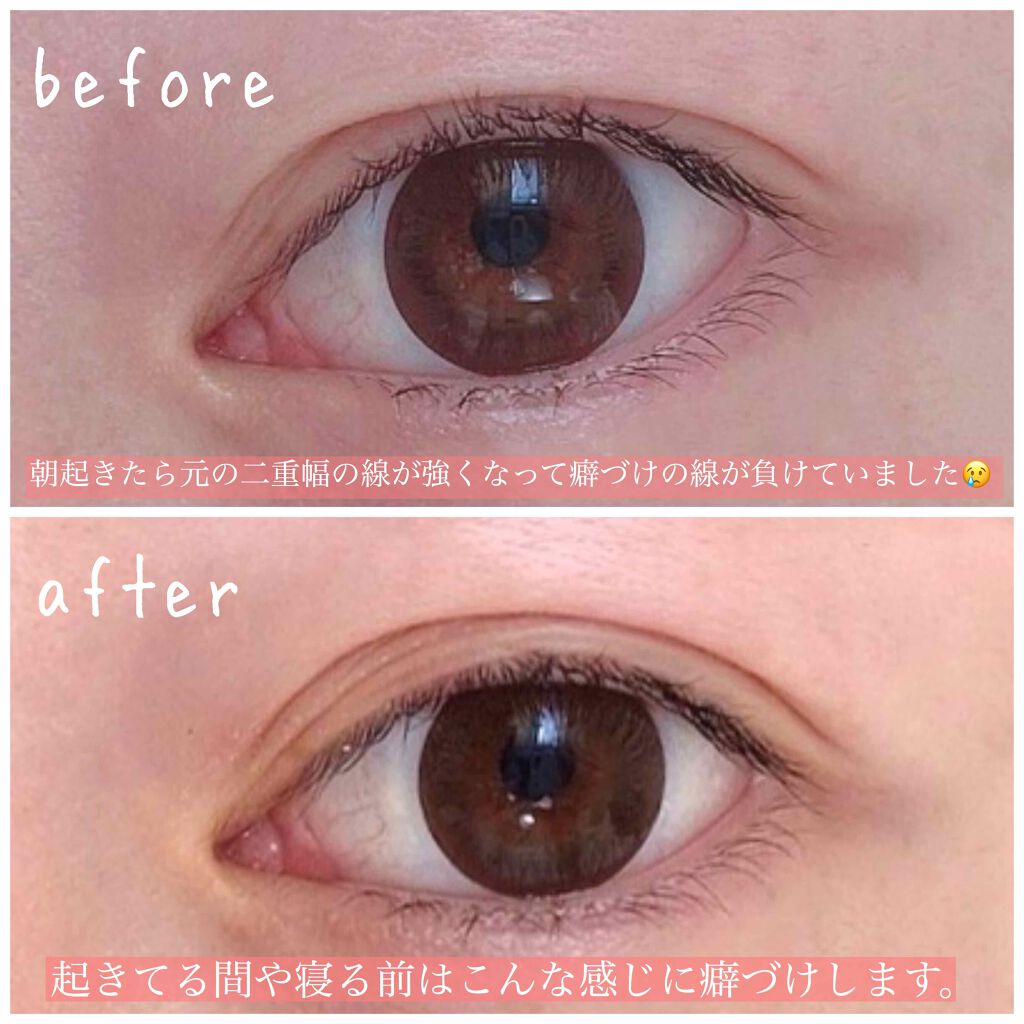 ナイトアイボーテ/StreeTrend/二重まぶた用アイテムを使ったクチコミ(3枚目)