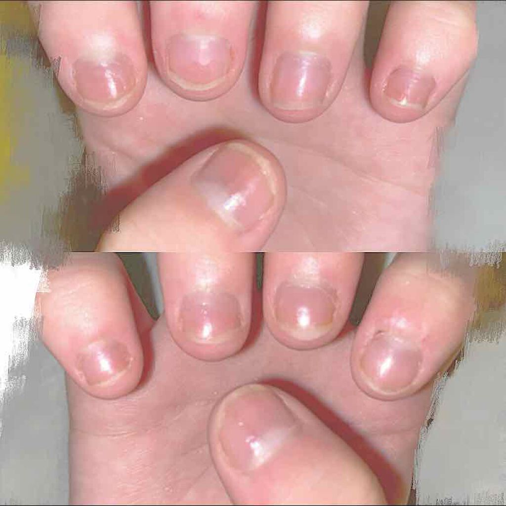 ネイルケアヴェール バイ リコアング/ウイング・ビート/オールインワンネイルを使ったクチコミ（2枚目）