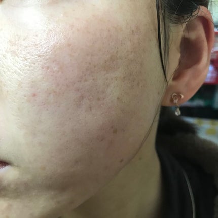 Cサスペンション23+HAスフィア2フェイスクリーム/The Ordinary/美容液を使ったクチコミ(2枚目)