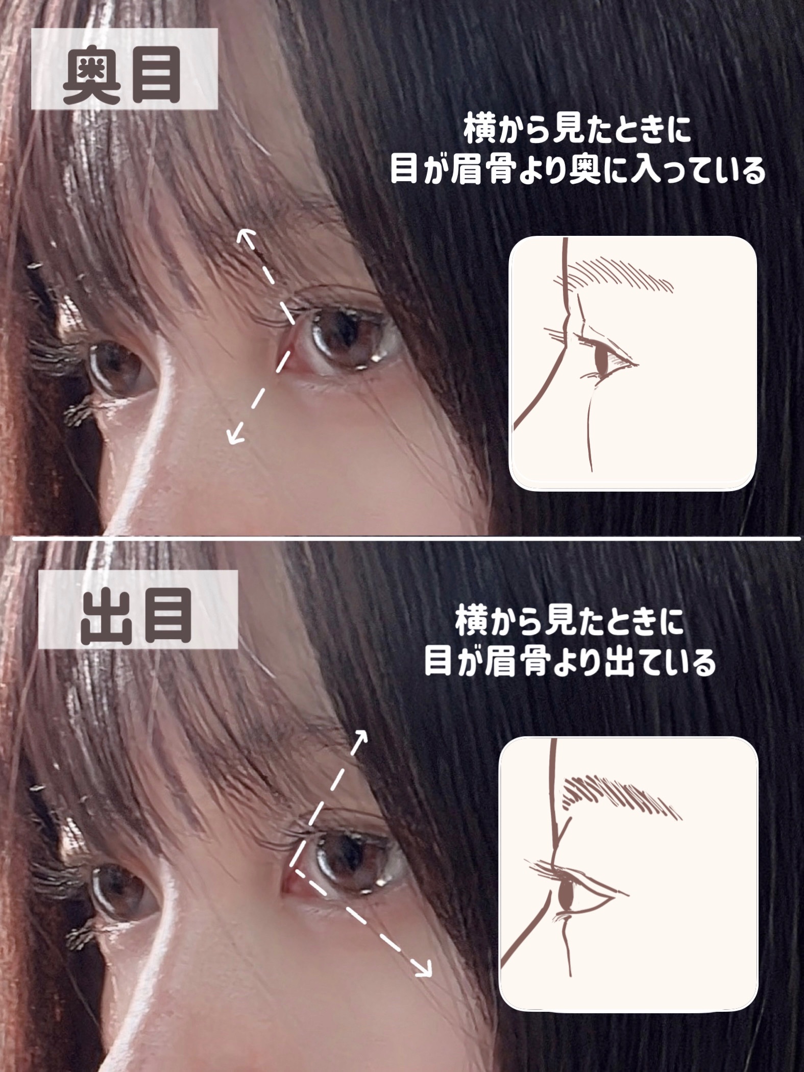 ひとえ・奥ぶたえ用カーラー/アイプチ®/ビューラーを使ったクチコミ（2枚目）