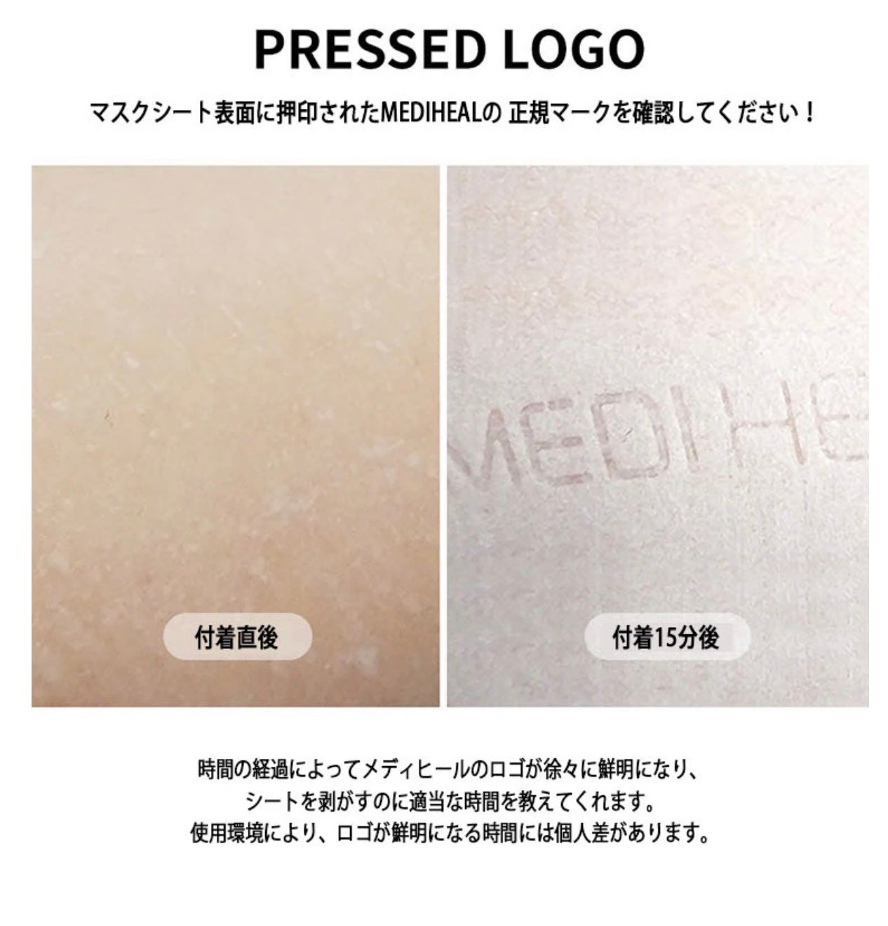 ビタライトビームエッセンシャルマスクEX/MEDIHEAL/シートマスク・パックを使ったクチコミ(8枚目)