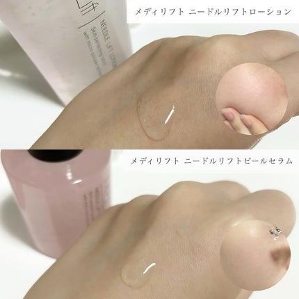 メディリフト ニードルリフトピールセラム/YA-MAN TOKYO JAPAN/美容液を使ったクチコミ(2枚目)